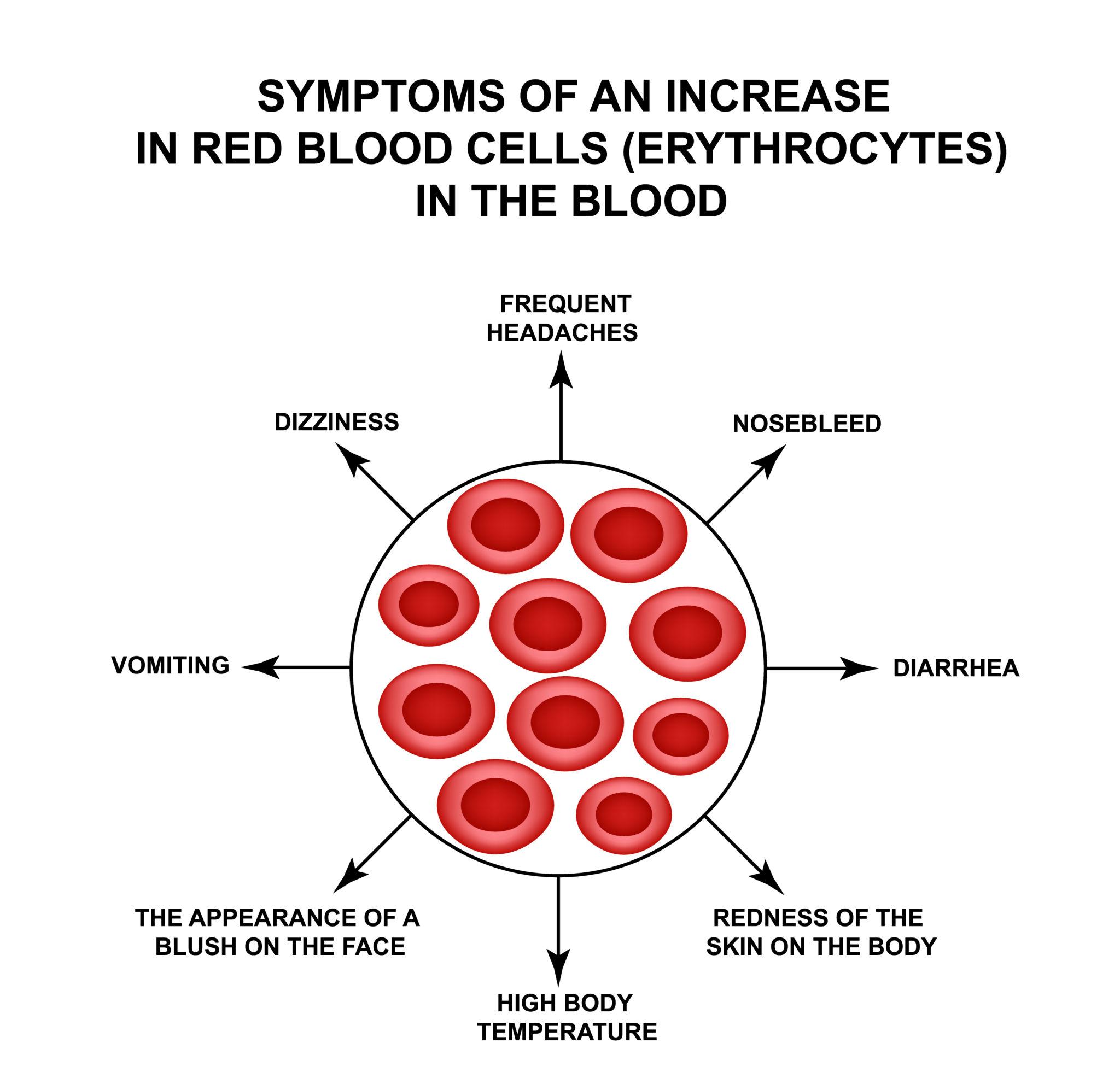 Polycythemia illustration showing dense red blood cells in the bloodstream